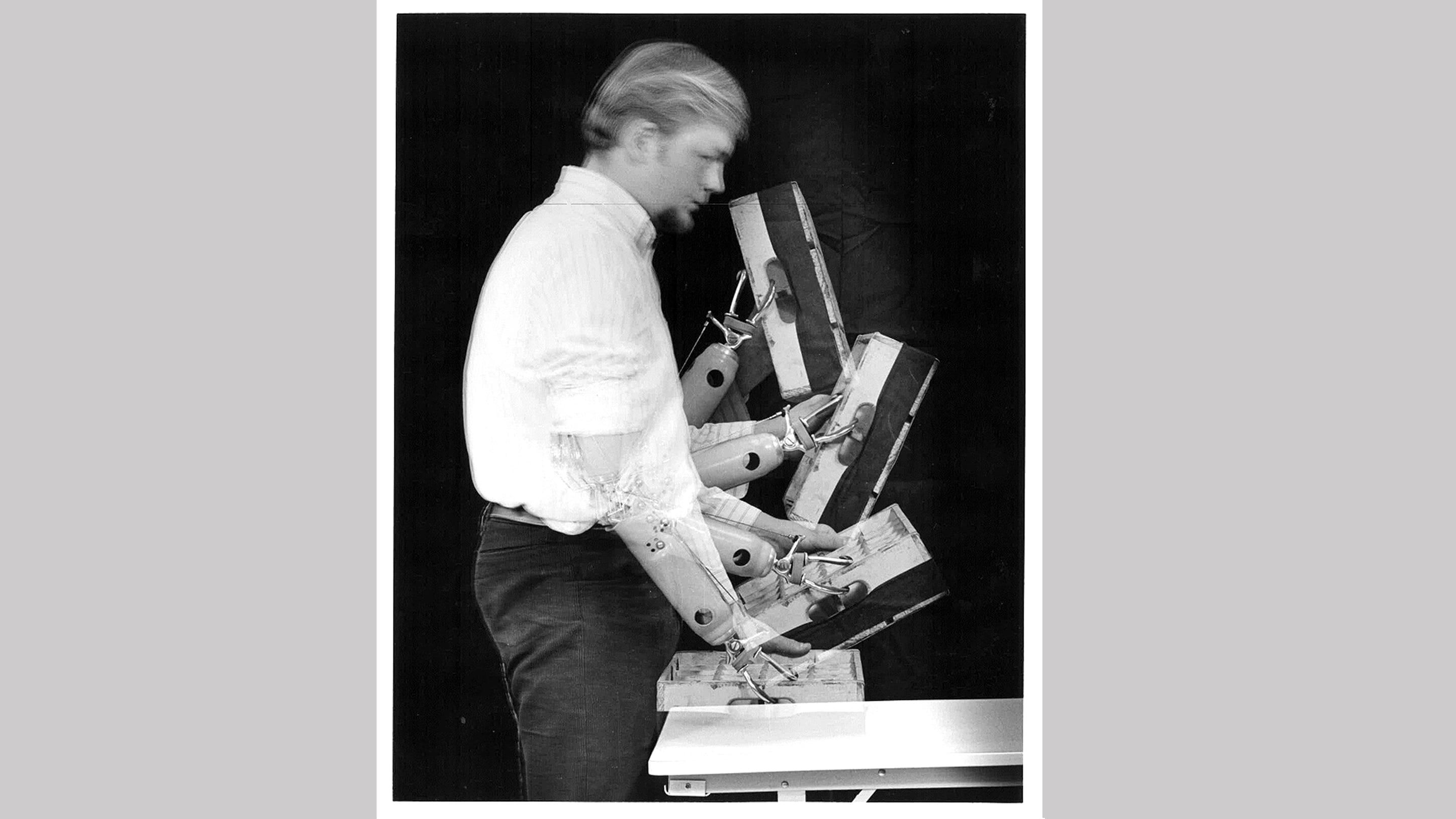 (slide 7 of 12) A man with the first battery-powered prosthetic elbow - 1960's.